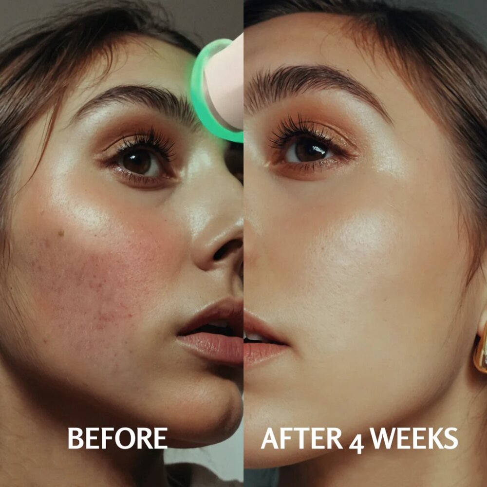 Cocobeauty PureO2 - Bioactive Delivery MicrOxygenation